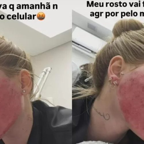 Virginia surpreende ao mostrar rosto após procedimentos estéticos