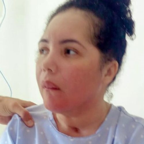 Irmã relata melhora de Amanda Wanessa: "Ficou sentada"